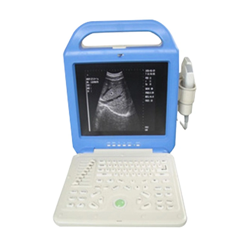 Instrumentos de ecografía médica veterinaria, totalmente digital portátil, portátil, Vet Ultrasound Máquina