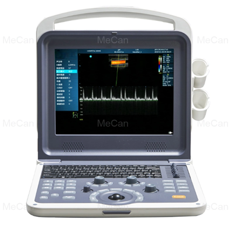 Échographie Doppler couleur numérique complète du système de diagnostic du scanner à ultrasons portable