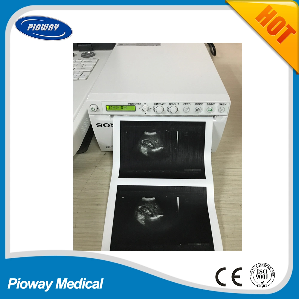 Ultrasound Machine Thermal Printer / Medical Video Printer Sony for Ultrasound System