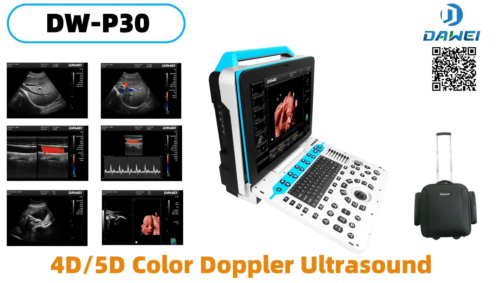 Dw-P30 New Design 15inch HD Image 3D 4D Ultrasound Scanner Factory Price