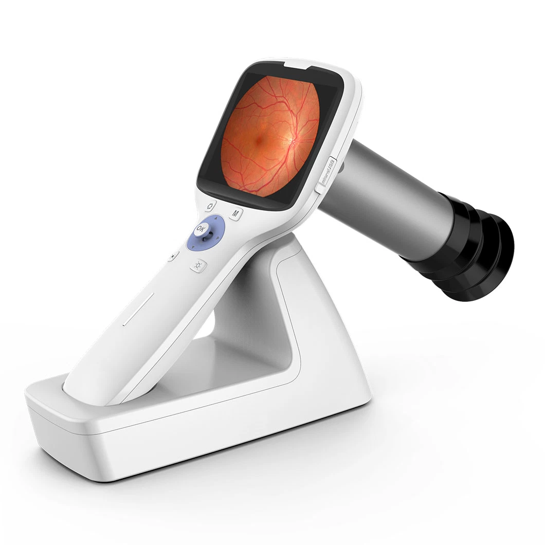 Hes-1000 Portable Handheld Non-Mydriatic Digital Fundus Retinal Camera