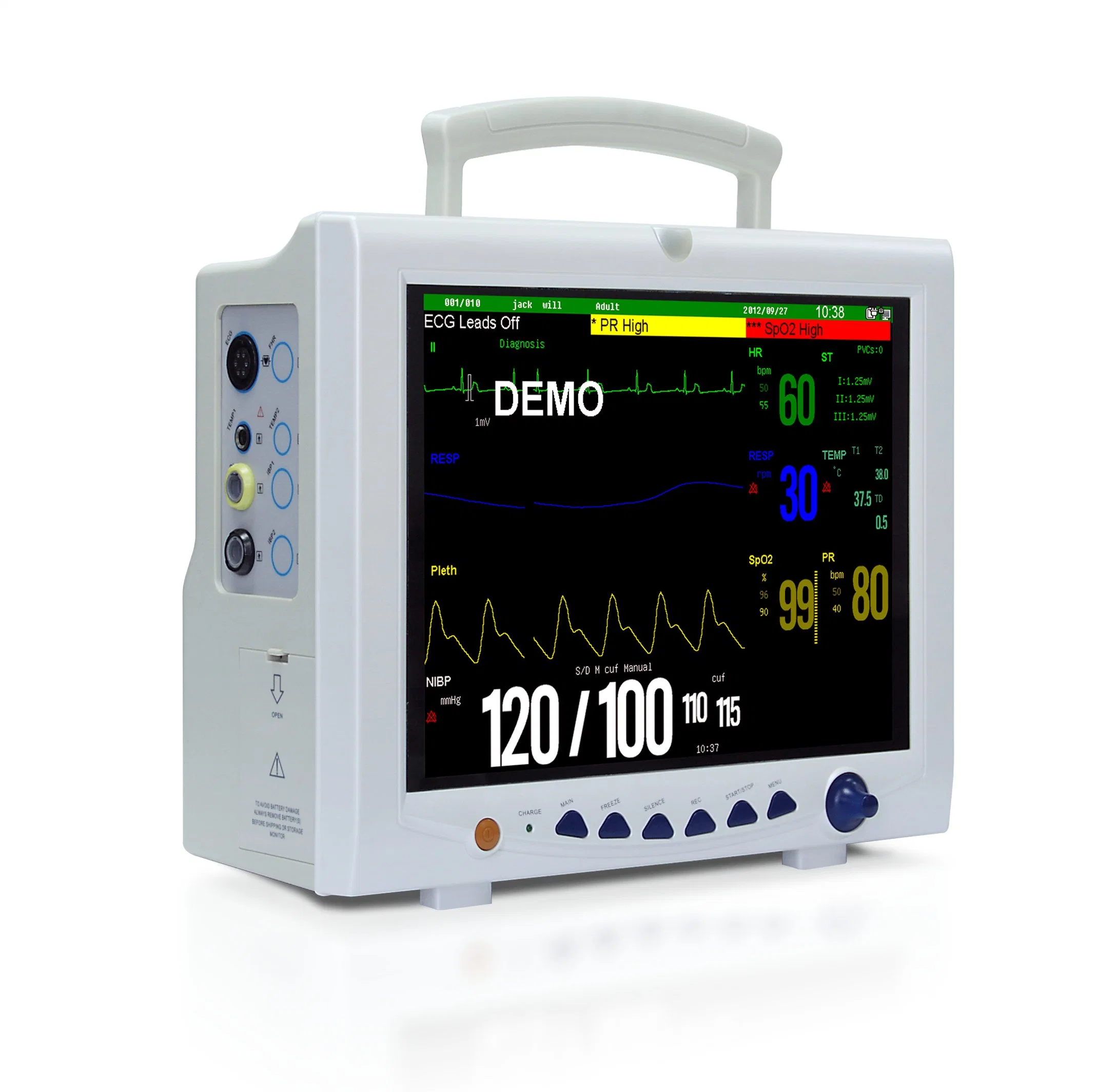 La CE aprobó 12,1 pulgadas de la ICU de ECG de Monitor de Paciente con la capnografía para equipo médico