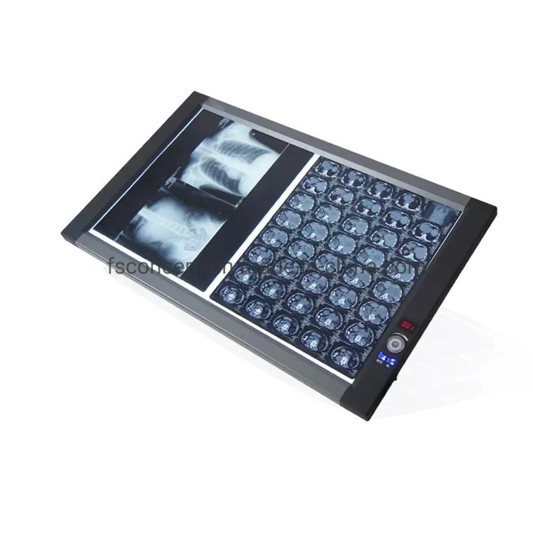 Varias pantallas de alta luminosidad LED Médicos Side-Lit Negatoscope Film Cuadro Vista