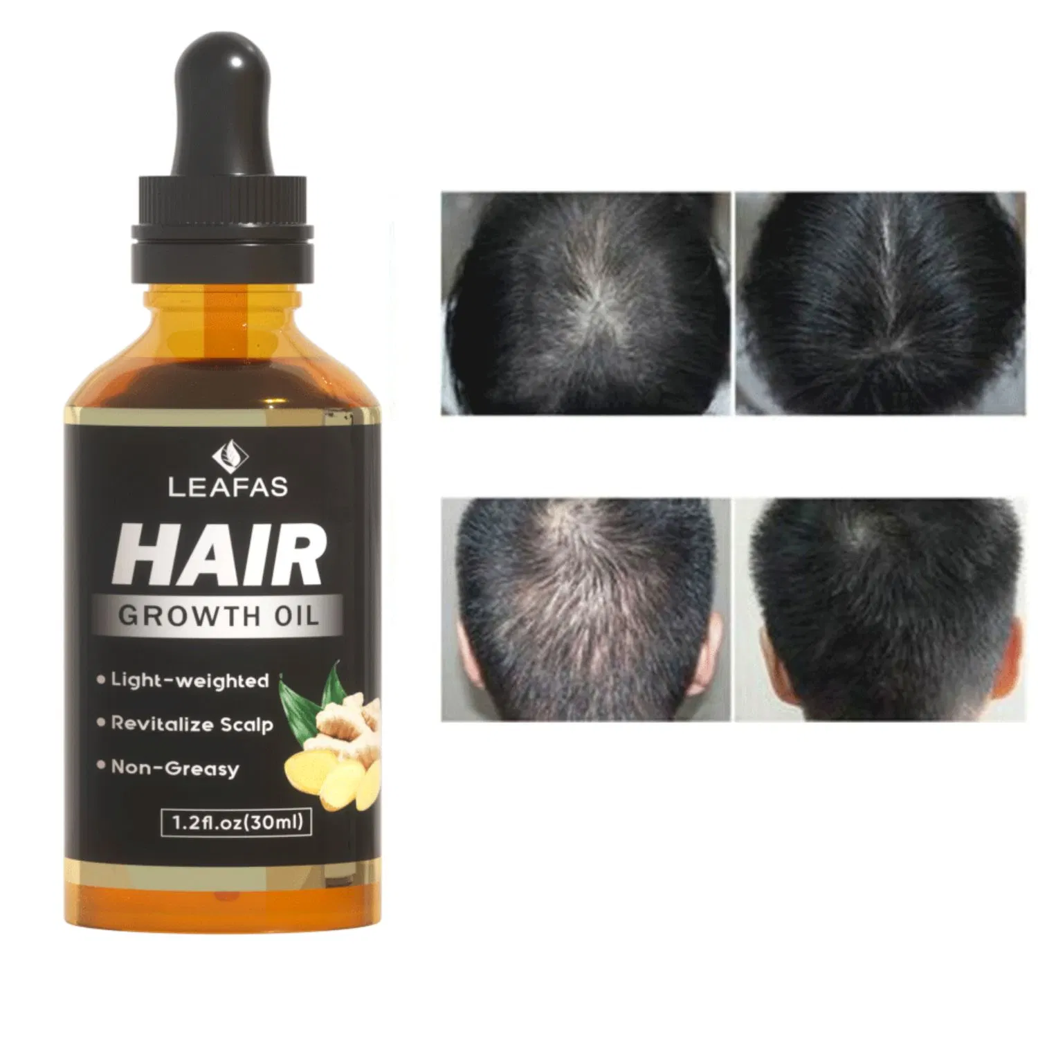 Custom Logo Hair Growth Oil for Men & Women