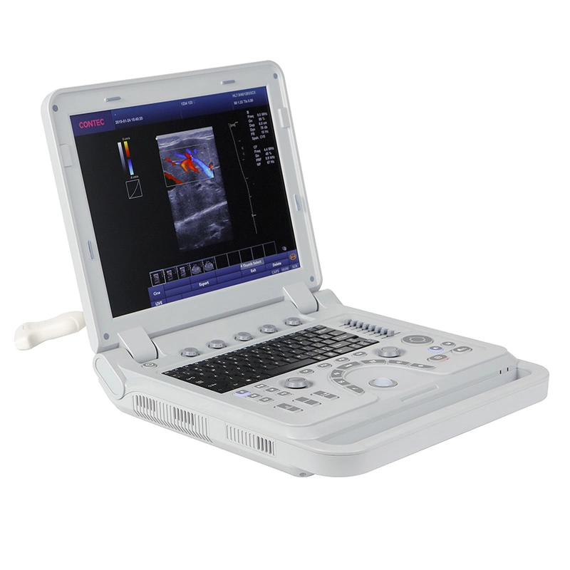 Vet 3D 4D Doppler color Equipo de ultrasonido médico Escáner de ultrasonido veterinario