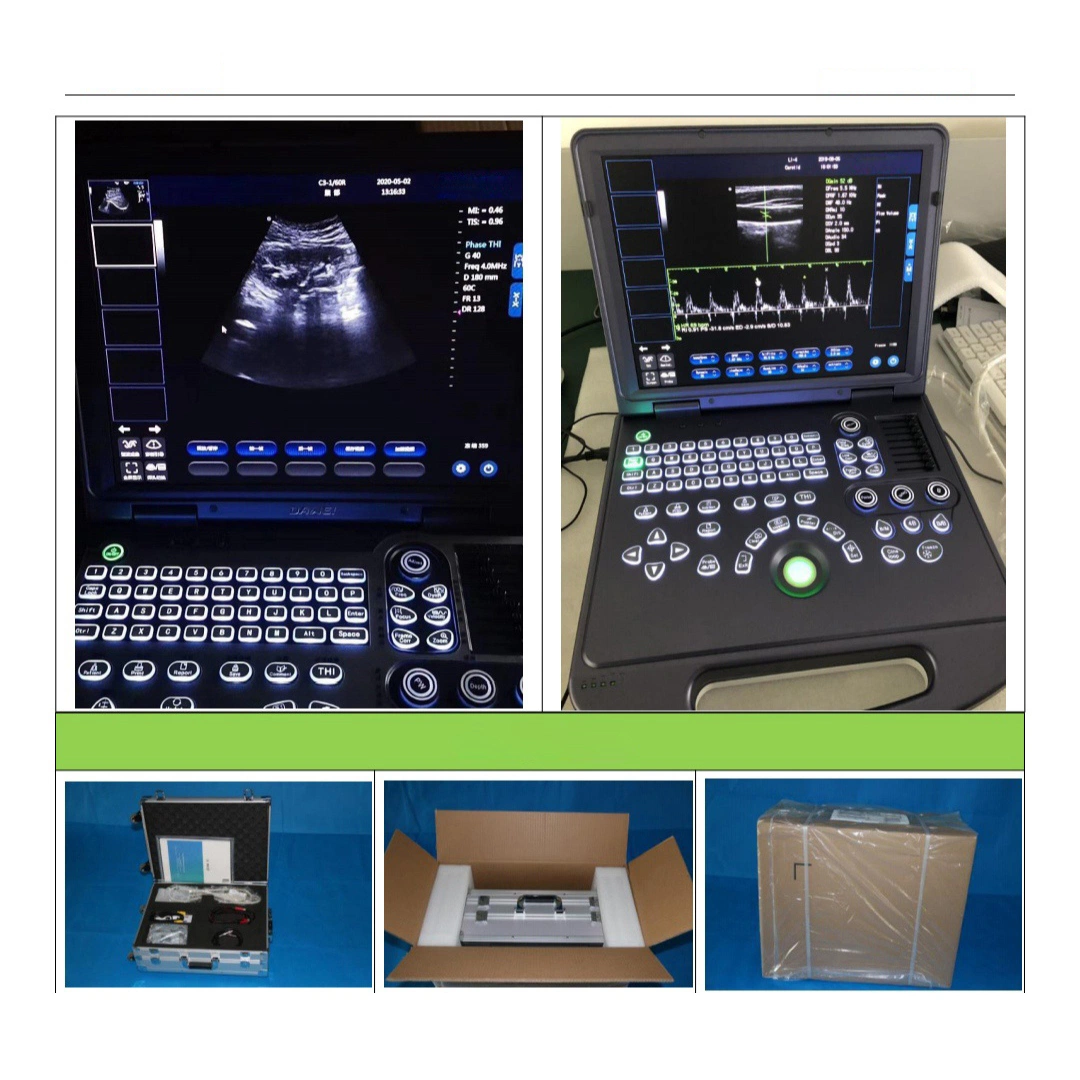 Wholesale/Supplier Price Medical Diagnosis Equipment Machine High quality/High cost performance Full Digital Pw Function Black and White B&W Portable Laptop Diagnostic Ultrasound Scanner