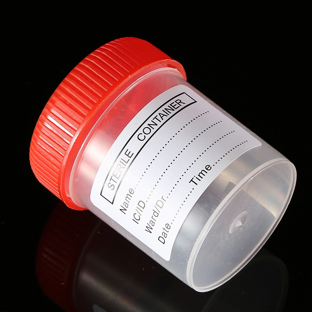 Disposable Laboratory Medical Test Sample Urine Container /Specimen Wholesale/Supplier