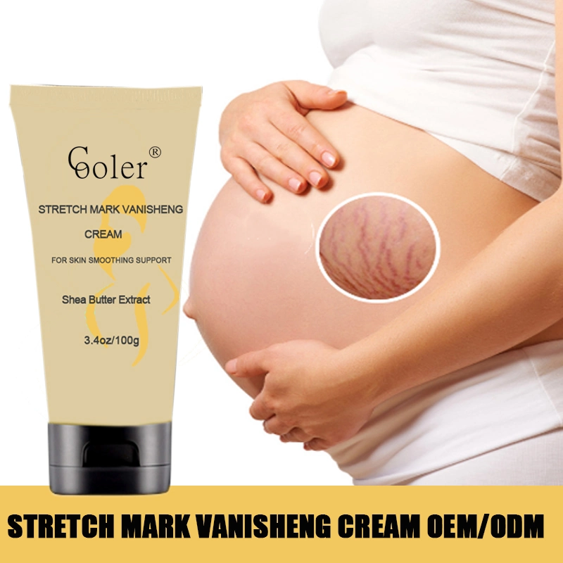 Hautpflege OEM Großhandel Narbe Entfernung Marken Stretch Mark Creme