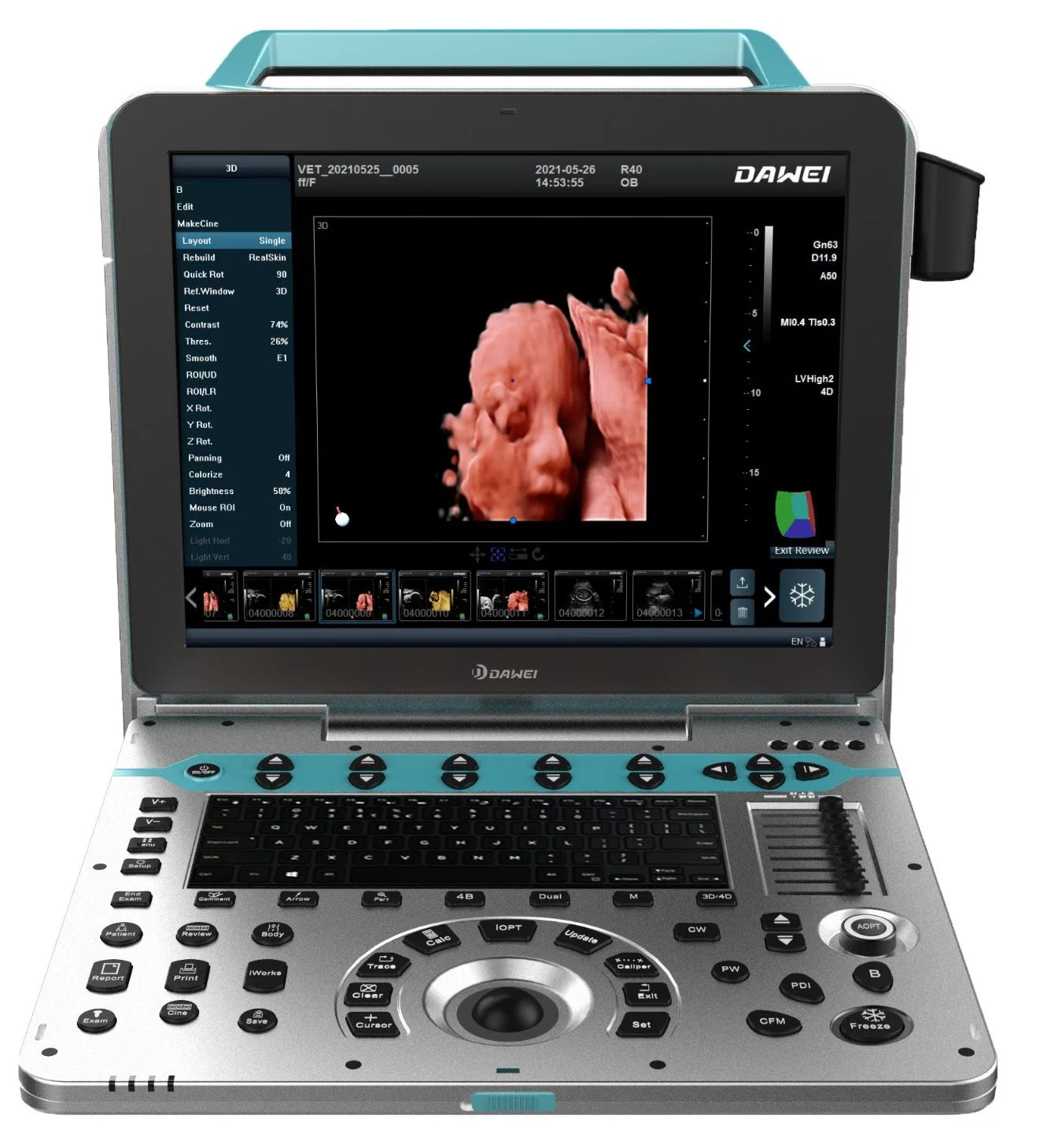 Dw-P30 New Design 15inch HD Image 3D 4D Ultrasound Scanner Factory Price