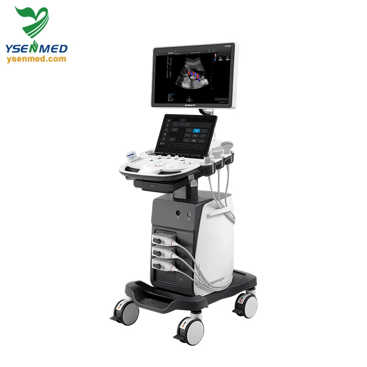 Sonoscape P9 Elite Trolley 3D/4D Color Doppler Ultrasound Machine Medical Equipment