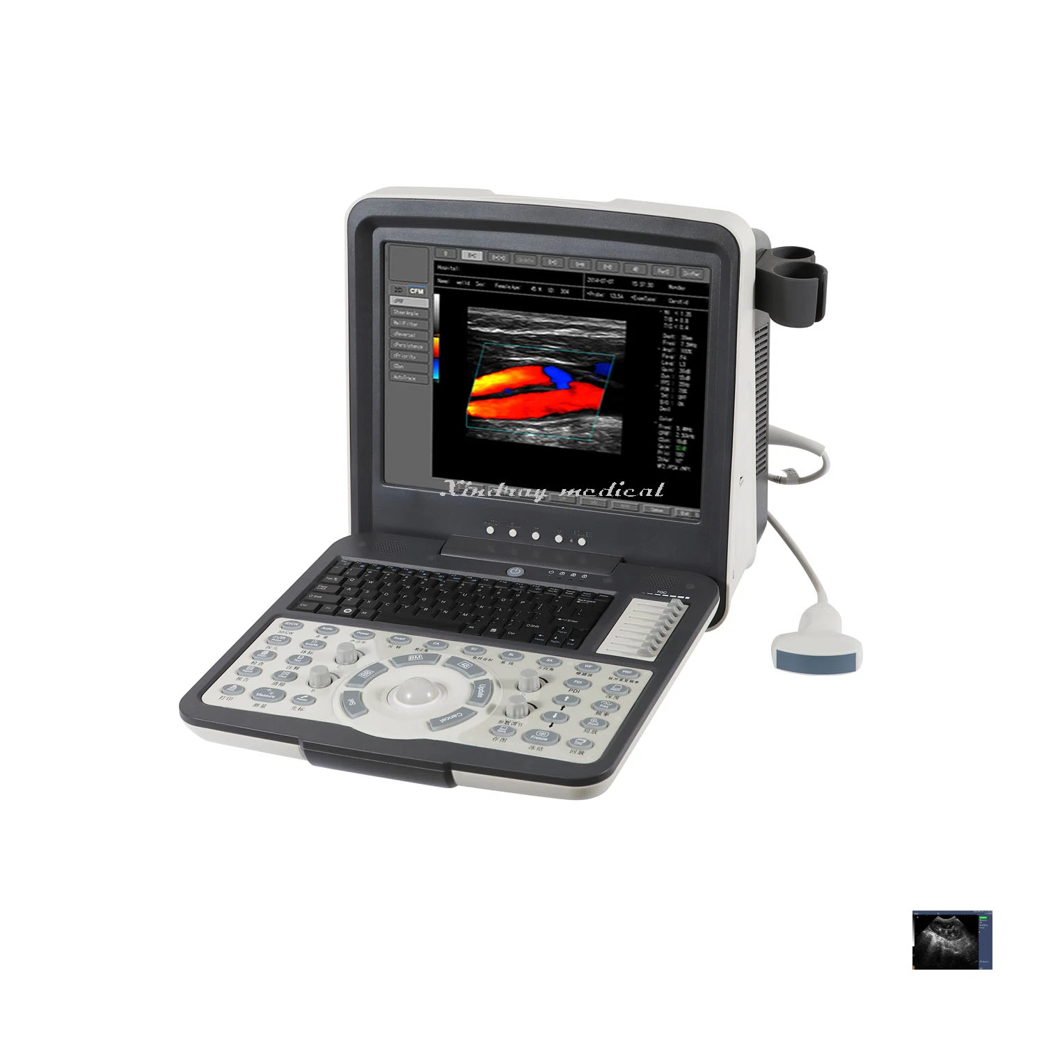 Hot Sale Doppler portátil de color Ultrasonido portátil totalmente digital Escáner