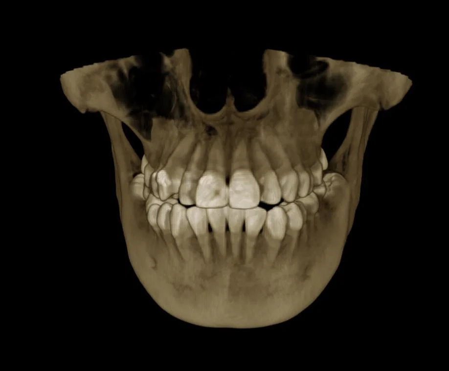 Smart 3D 2D-Медицинской цифровой панорамный Cephalometric Кткп стоматологическая рентгеновского оборудования для диагностики с сертификат CE стоматологии