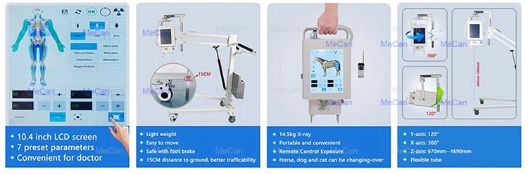 X Ray Equipment Patient Portable X-ray Machine for Hospital