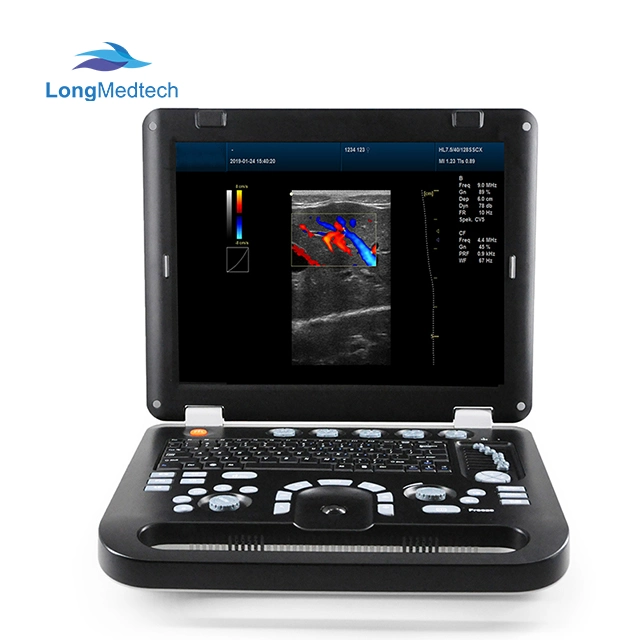 Tragbarer Laptop Voll-Digital-Farbdoppler-Ultraschalldiagnostikinstrumente