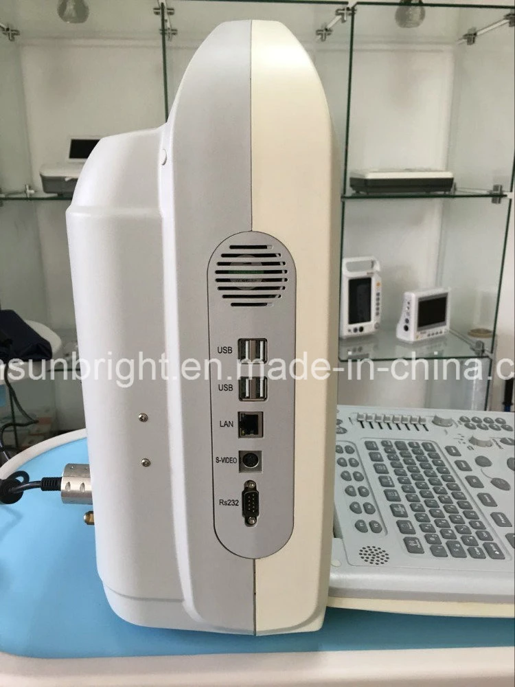 Portable Echo Color Doppler System 2D Ultrasound Machine