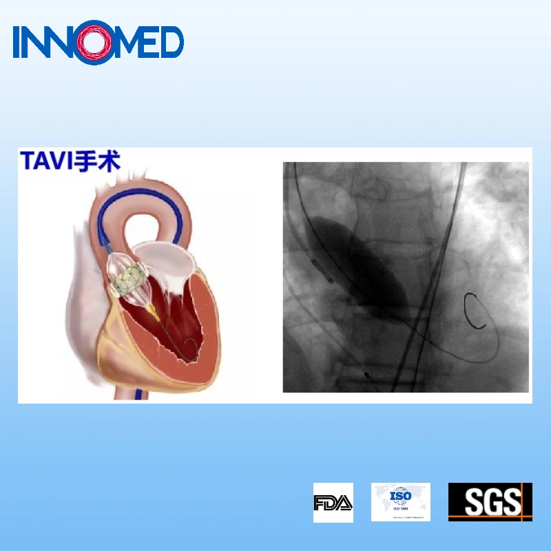 Inno Tavi-Wire for Establishing Access