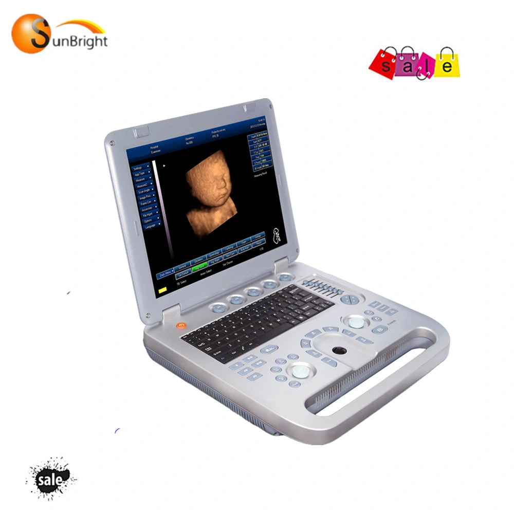 Best Ultrasound Portable 3D Cardiovascular Ultrasound Machine Scanner