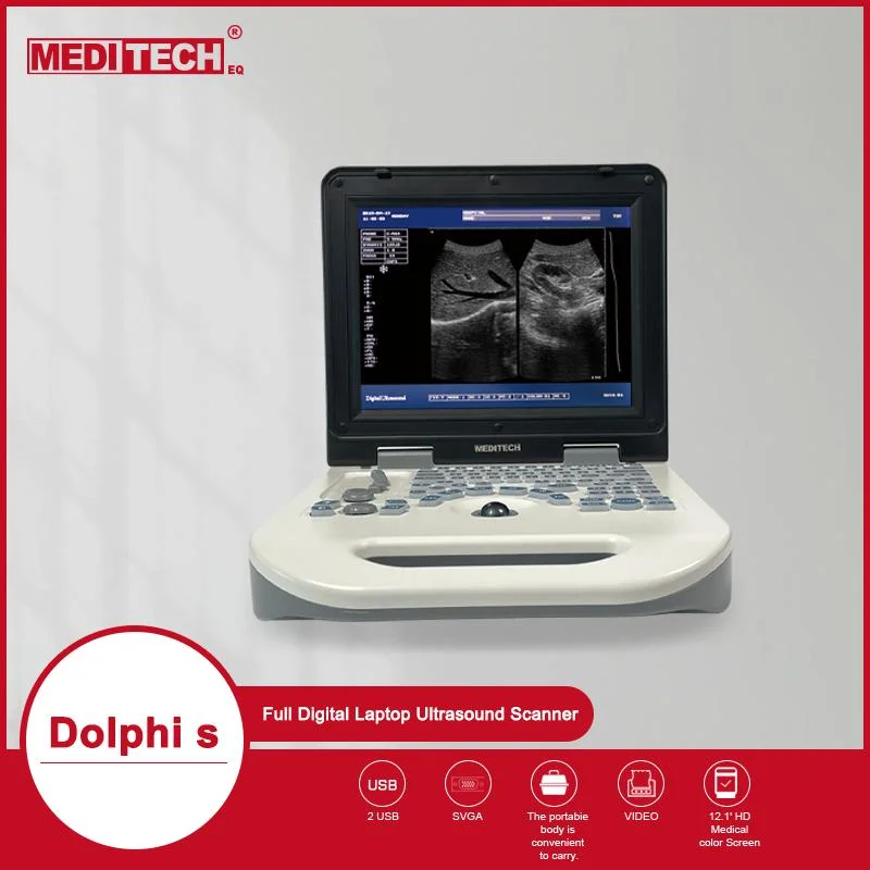 Dolphi-S New Full Digital B/W Ultrasound Scanner