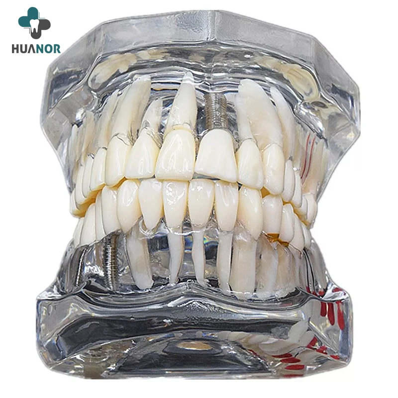 Dentista médico modelo de Anatomia Dental Modelo Dente estudo 32 dentes Modelo com Base