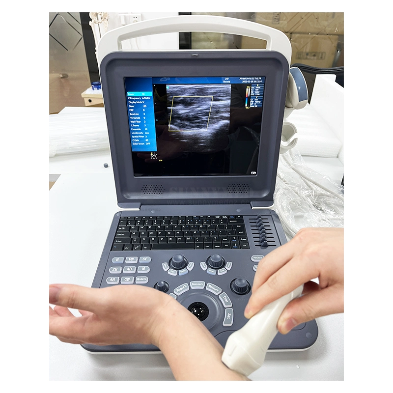 Sy-A042-1 High quality/High cost performance Clinic Medical Ultrasound Instrument Laptop Color Doppler Device