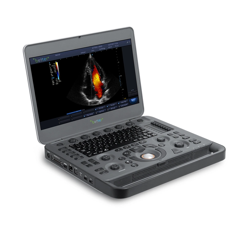 Color Doppler Sonoscape X5 for Pregnancy with Probe