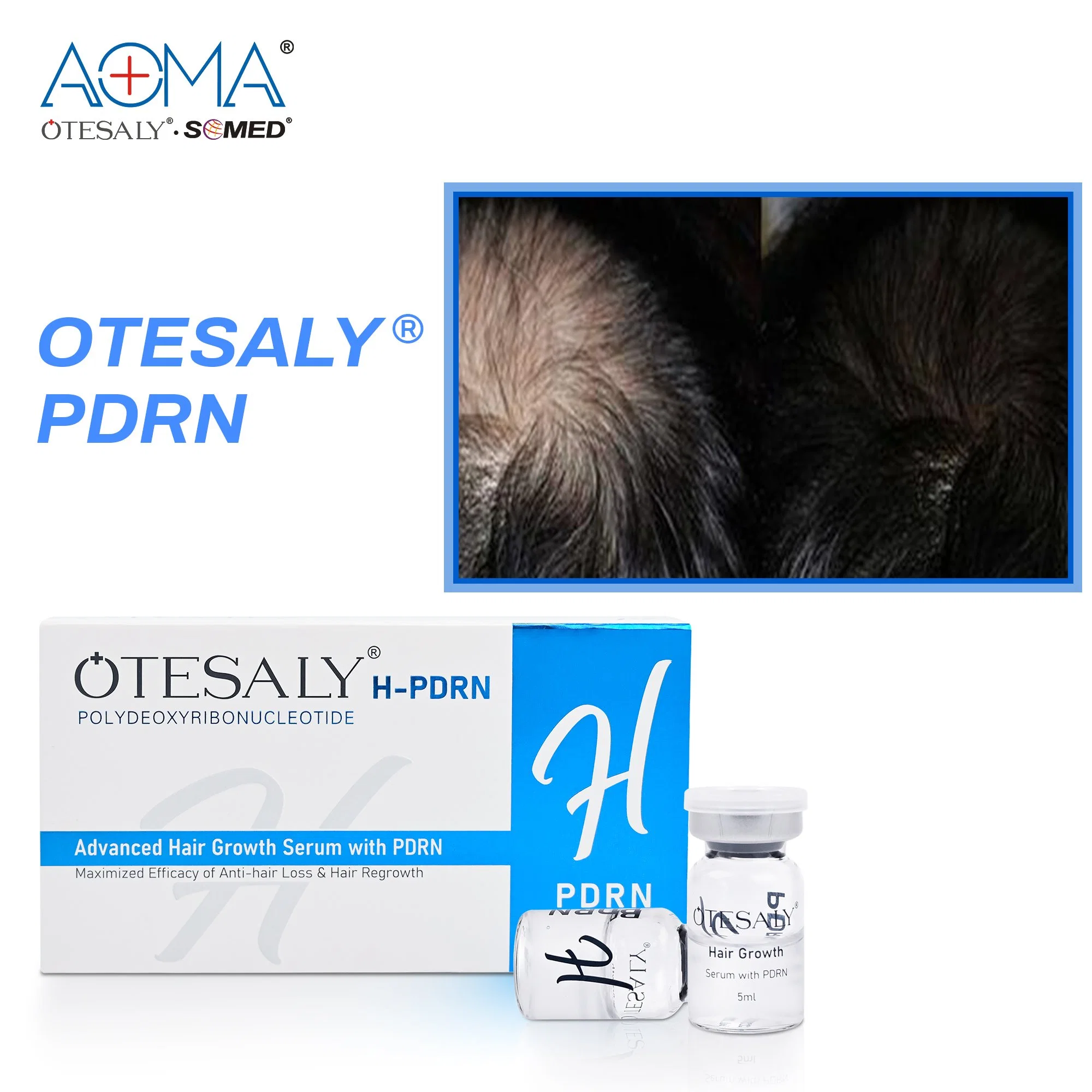 Suministro de fábrica Otesaly Advanced Hair Growth suero Pdrn ampollas de mesoterapia Inyección de pelo