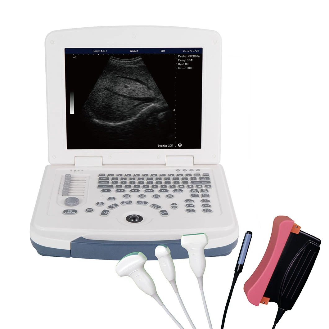 Best Sale Ultrasonic Diagnosis Equipment Laptop B/W Animal Ultrasound Machine