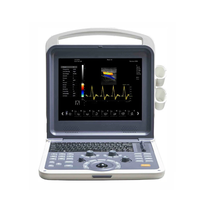 My-A035b Medical Supplier Cheap Portable Ultrasound Vet Sheep Ultrasound Machine Color Doppler 3D 4D