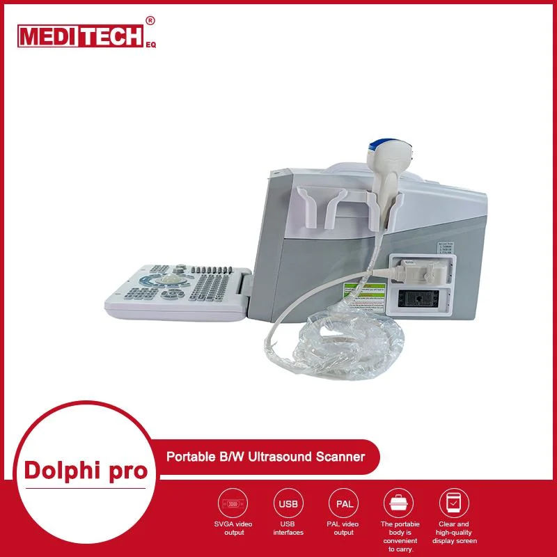 Medical Equipment Portable B/W Ultrasound Scanner, 4D Display USB Port to Transfer Data