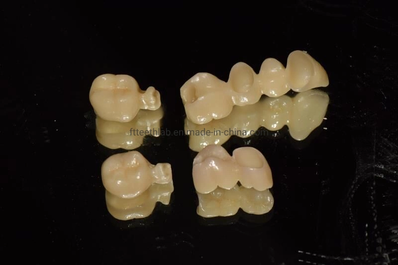 Kieferorthopädische Produkte Dental Material Supplies CAD Cam Dental Implant Crown Hergestellt in China Dental Lab