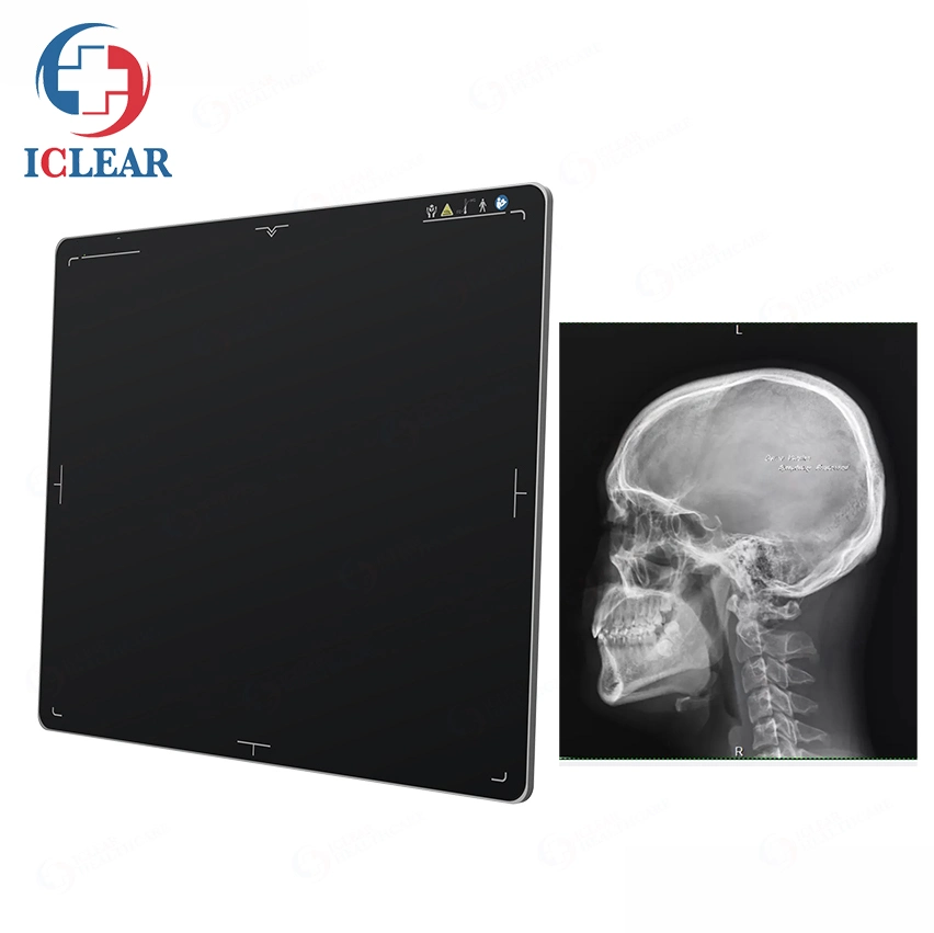 Iray 17X17 Com fio Sem fio Radiografia Digital Detector de Painel Plano