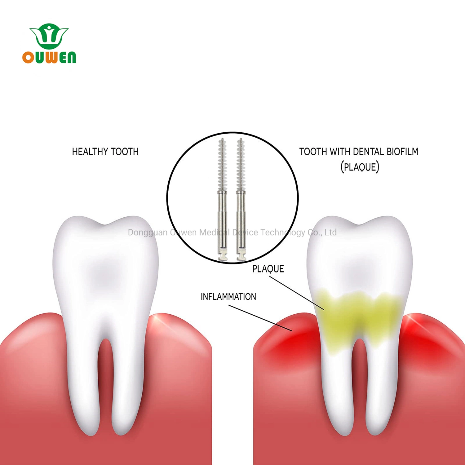 Good Quality Inter Dental Disposable Polishing Root Canal Cleaning Brush