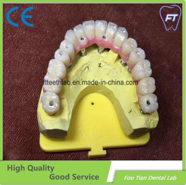 Material Dental material de implante-en-6 de contorno superior completo de Zirconia Implantes Dentales Bridge