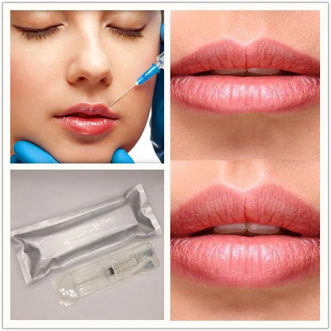 Hyaluronsäure mit CE-Zertifikat Injectable Gesichts Dermal Filler 2ml Zum Kaufen