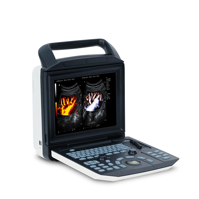 Ysb-M5 Medical Portable Color Doppler Ultrasound Scanner