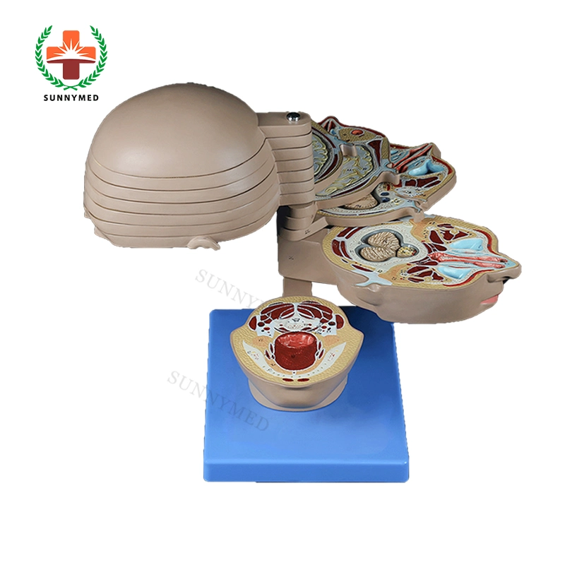 Sy-N087 Human Head & Neck Transection Anatomical Model for Teaching Training