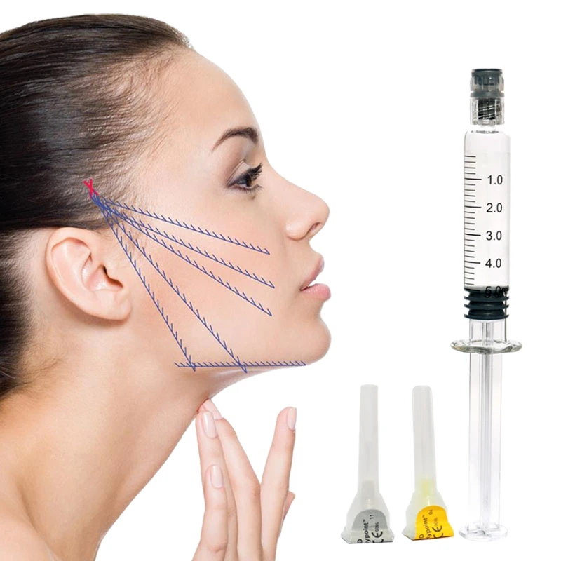 Hyaluronic Acid Forehead Mouth Lines Face Filling Injection Dermal Filler 5ml