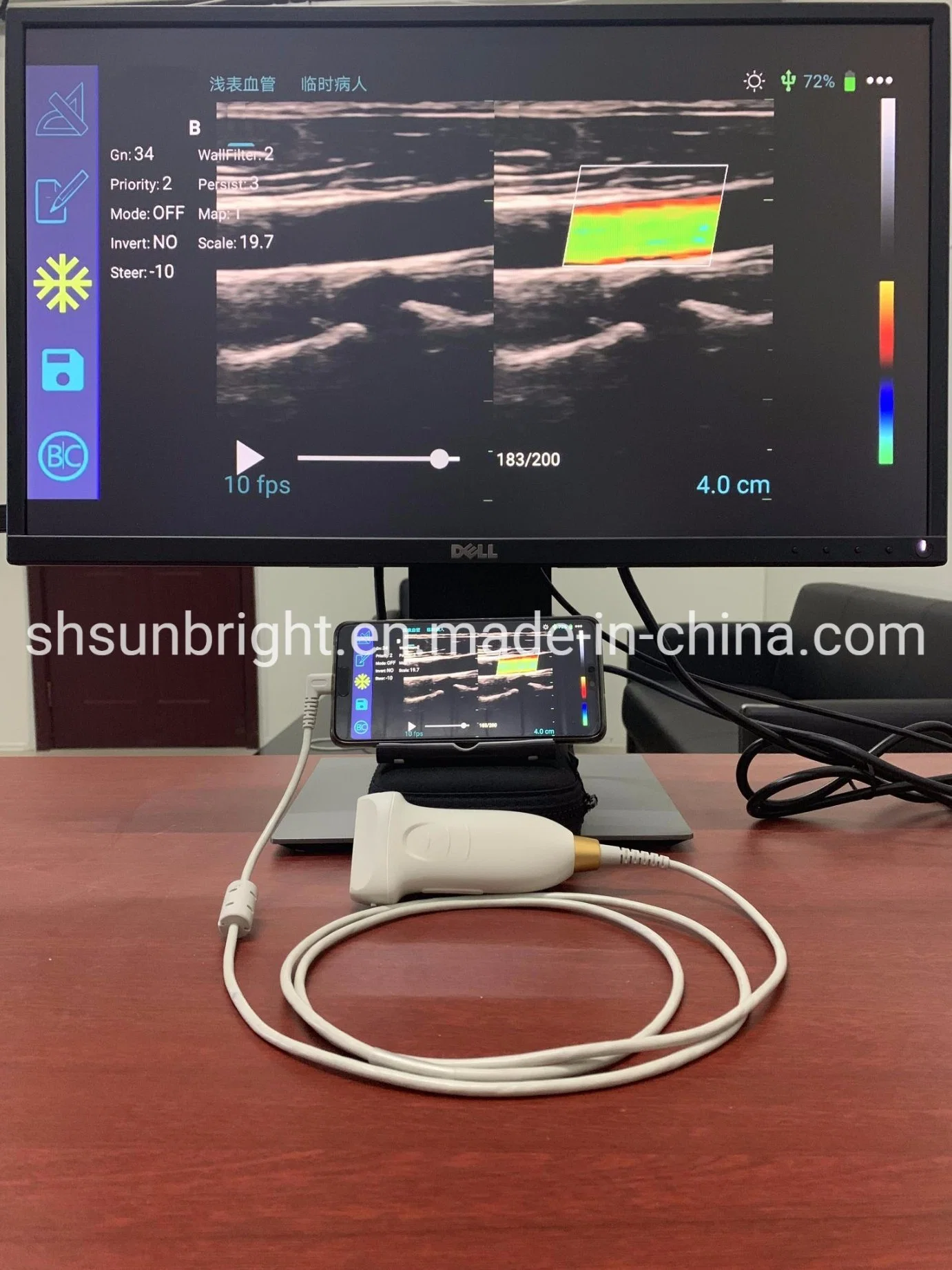 Affordable Color Doppler Software Pw Vascular Test Linear Probe