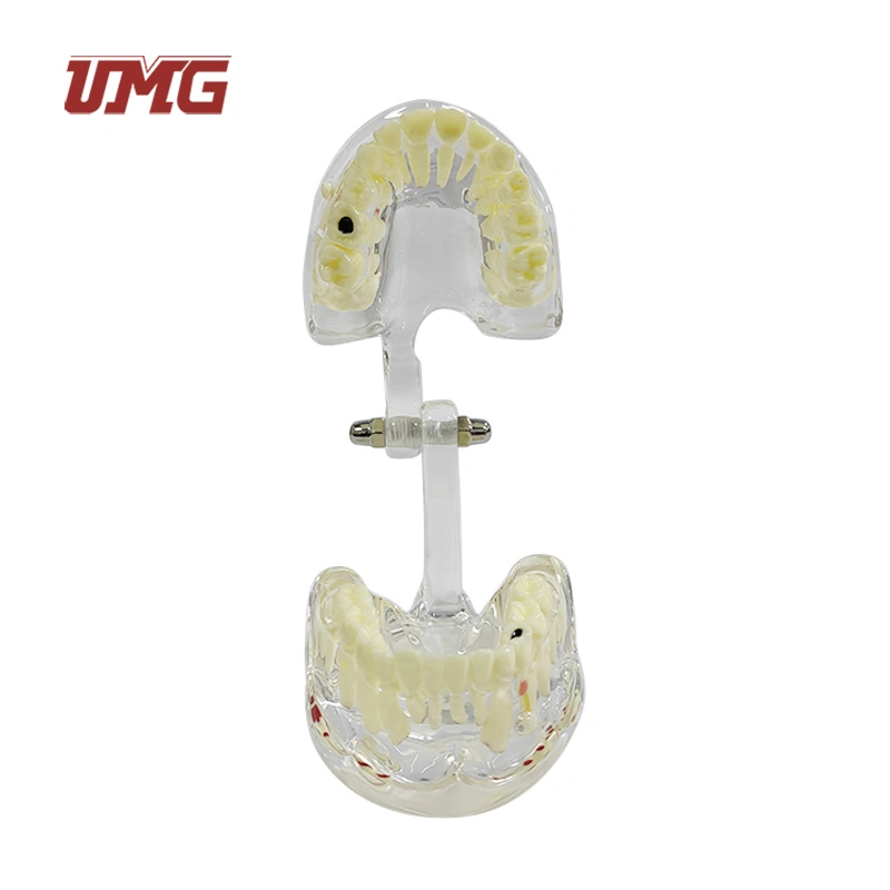 Pediatric Model with Pathologies Dentiion of Age 6-9