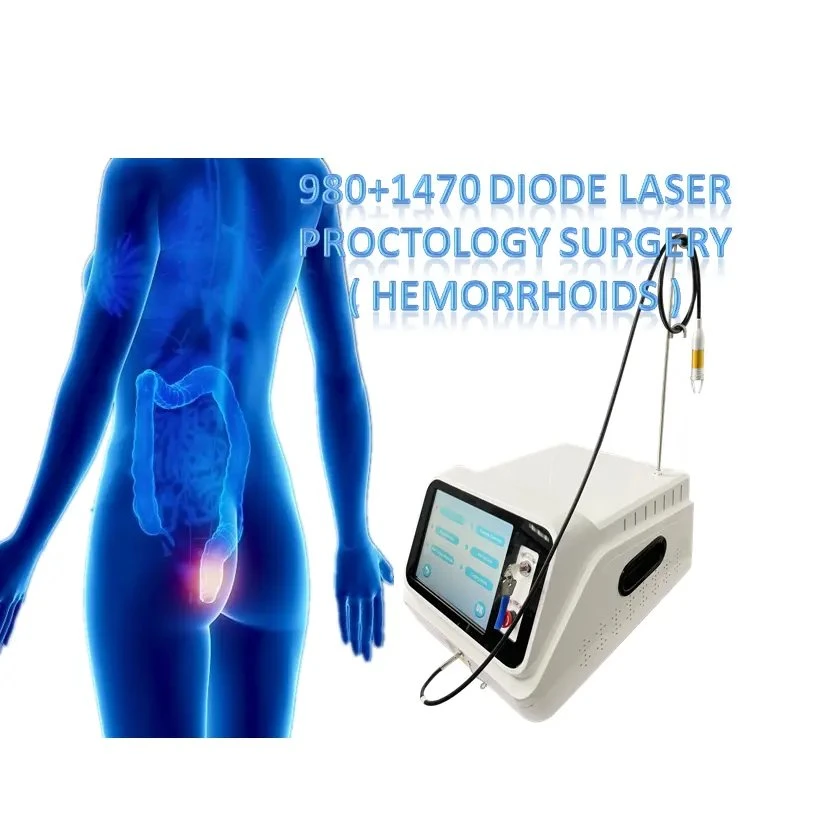 Laser minimamente invasivo 1470 tratamento de pilhas/fístula/varizes do seio pilonidal Dispositivo de remoção de hemorróidas