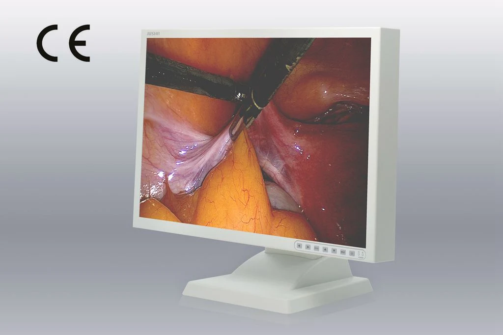 24-Inch 1920X1200 LCD Screen Endoscope Monitor, CE Approved, Endoscope Image System