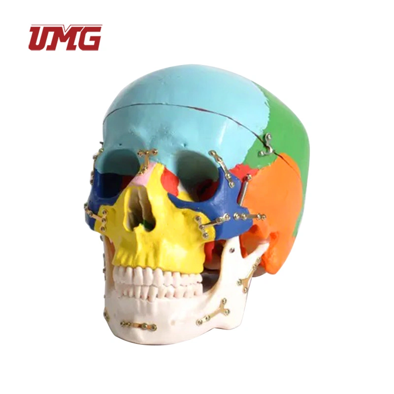 Colorful Skull Model Anatomical with Titanium Plate for Medical Training