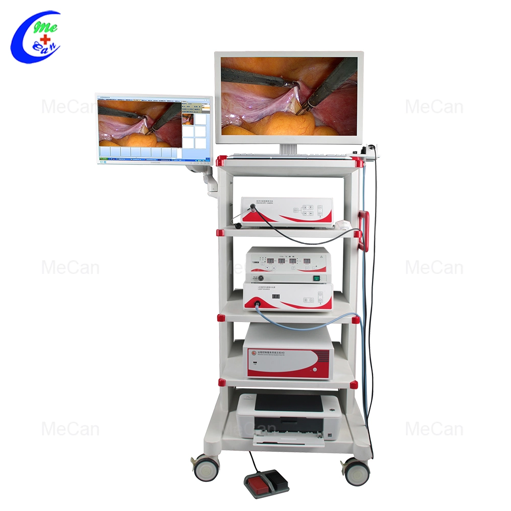 Medical Video Laparoscopy Laparoscope&#160; Endoscope