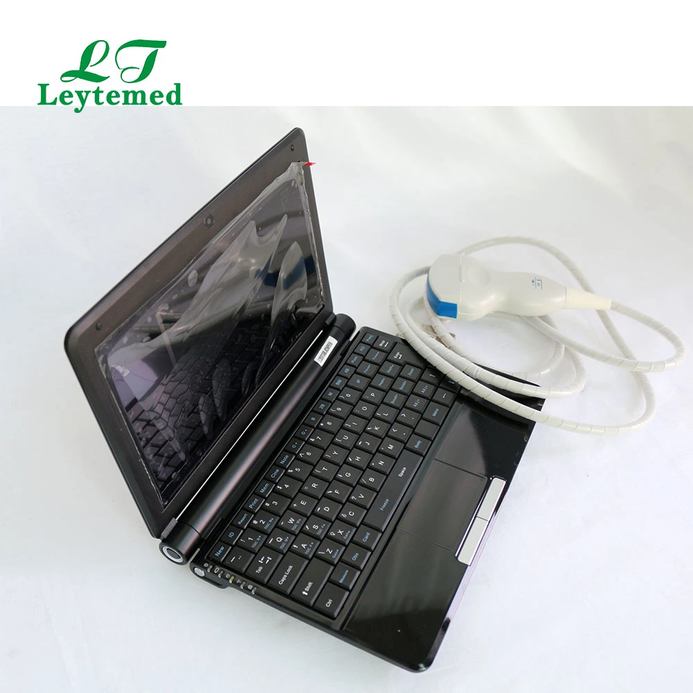 Ltub25 Laptop Portable Full Digital Medical Pregnancy Scanner Ultrasound Echography Equipment