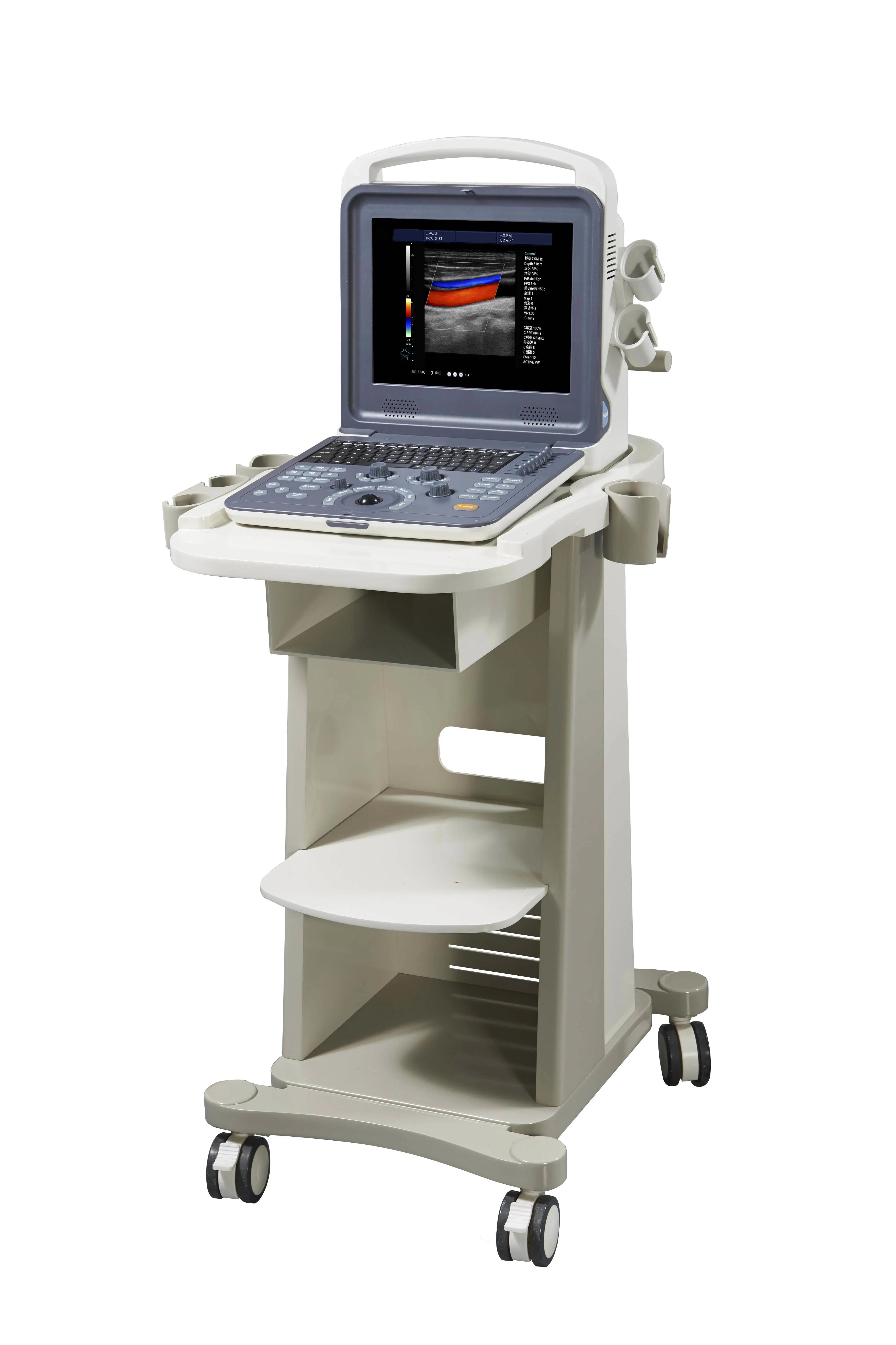 Portable Color Doppler Ultrasound Scanner Similar Chison Eco 5