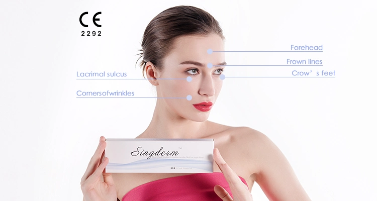 Singderm Cheek/Lip/Nose Filler Enhancement Cross-Linked Ha Derma Filler 0.3% Lidoc with CE