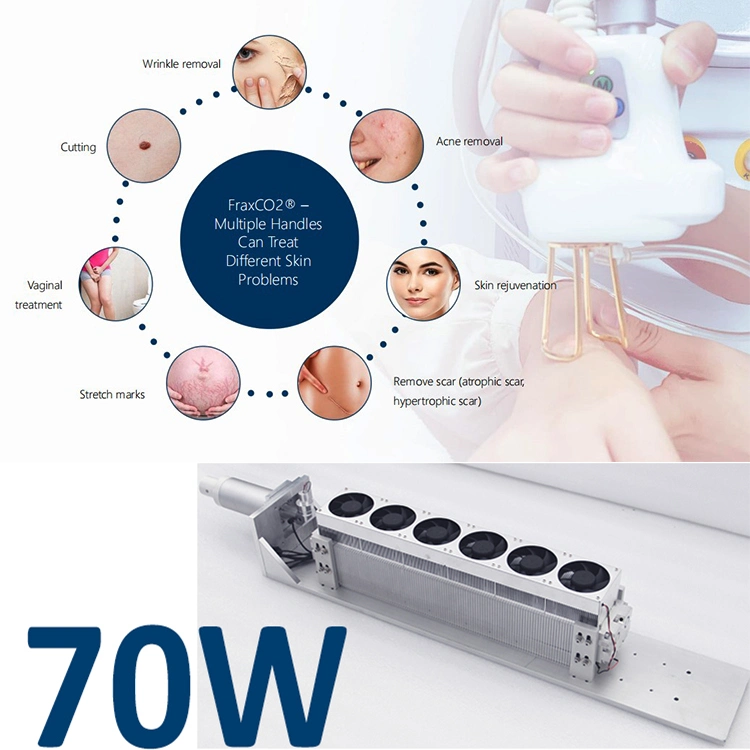 70 واط معتمدة من CE لليزر الطبي لعلامة تمدد كشط حب آسن إزالة الكسسسزيتية 10600 نانومتر ثاني أكسيد الكربون الليزر آلة إحكام المهبل