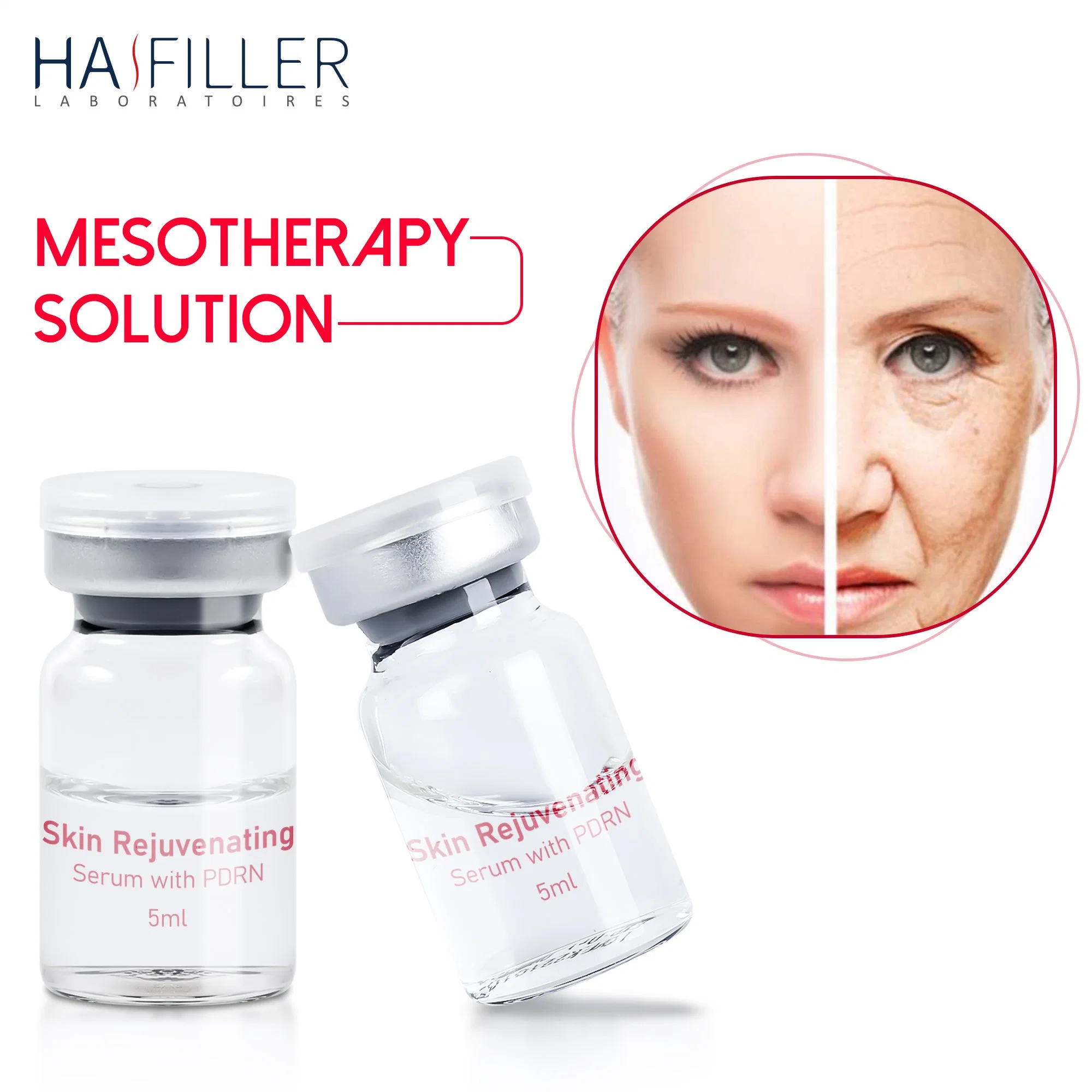 Heißer Verkauf Anti Falten Haut Rejuvenation Serum Pdrn Hyaluronsäure Injektions-Mesotherapie