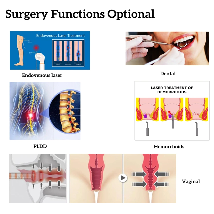 World Lightest Laser Diode Equipment with Special Designed 980 Nm Diode Fiber for Piles, Fistula & 1470 Nm Diode Fiber for Varicose Vein Medical Laser Beauty