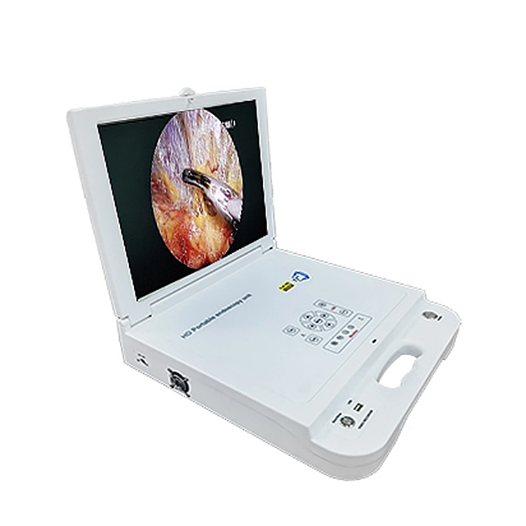 Medizinische Diagnosegeräte Otoskop Video HD Tragbares LCD Video Endoskop Kamerasystem für die Ent-Chirurgie
